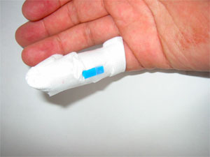 取り敢えず止血